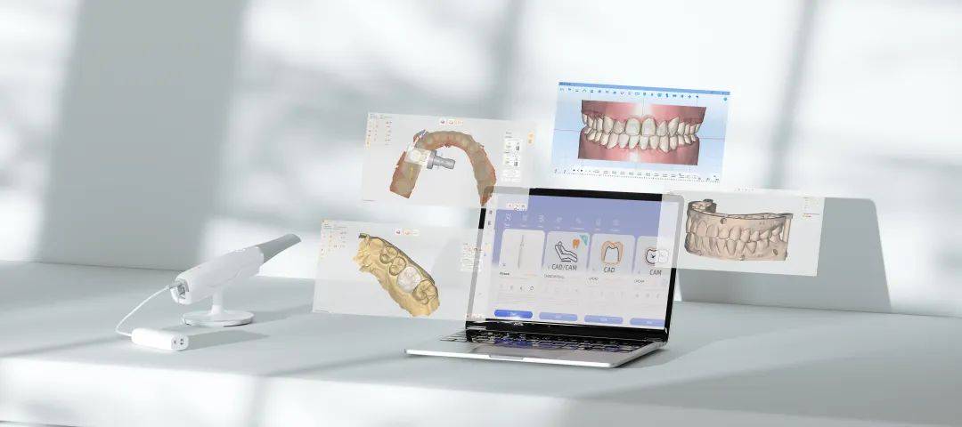 國(guó)內(nèi)首家齒科數(shù)字化CAD/CAM軟硬件研發(fā)企業(yè)落戶(hù)拱墅，推動(dòng)計(jì)算機(jī)系統(tǒng)集成創(chuàng)新發(fā)展